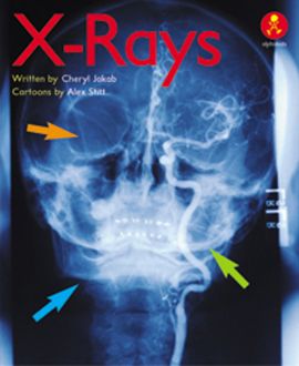 X-Rays